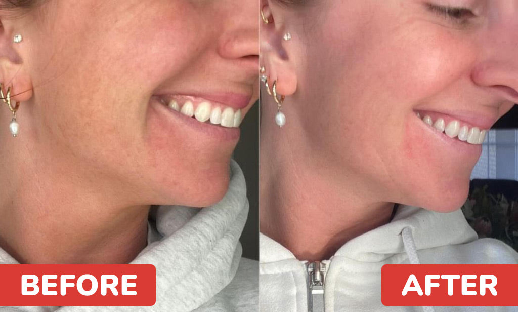 Before And After Image